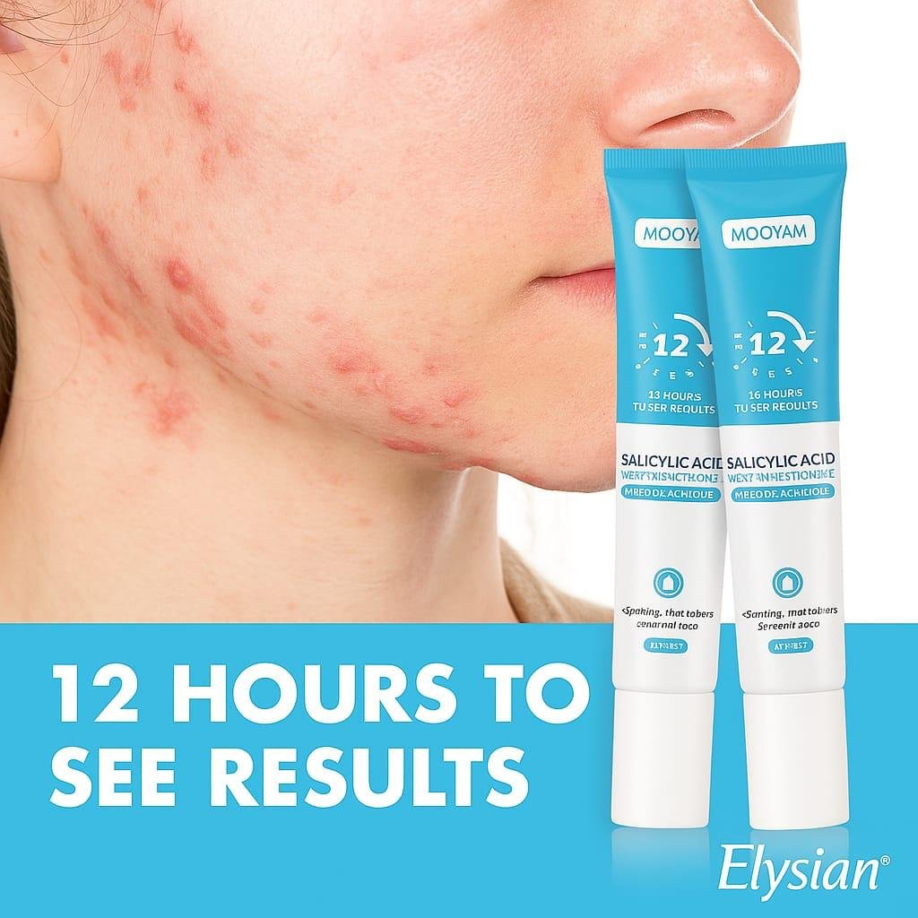 Acne Relief Spot Cream