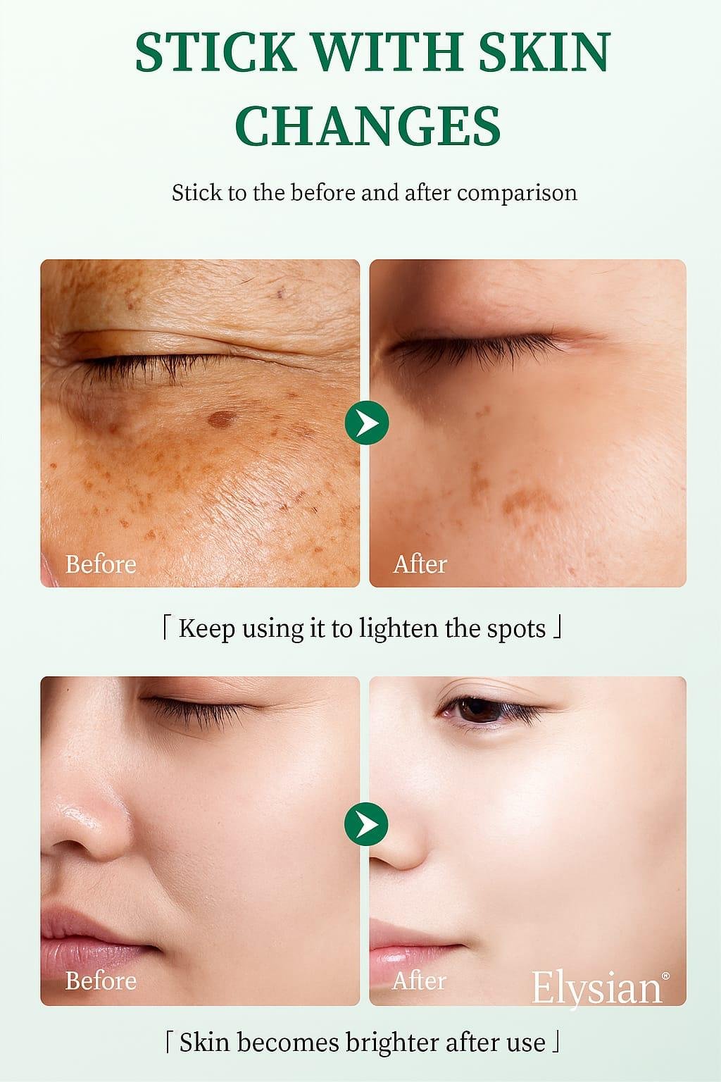 MOOYAM Dark Spots Corrector