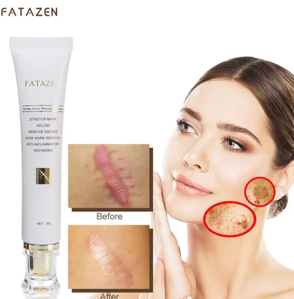 FATAZEN Scar Repair Cream - Image 2
